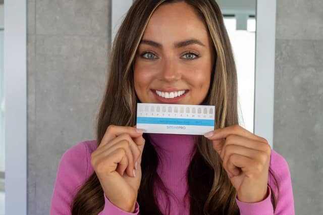 Smile Pro before & after: The seven-day smile upgrade everyone’s talking about (aff)