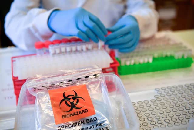 Coronavirus cases are slowing down in Hertfordshire