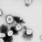 Coronavirus stock image