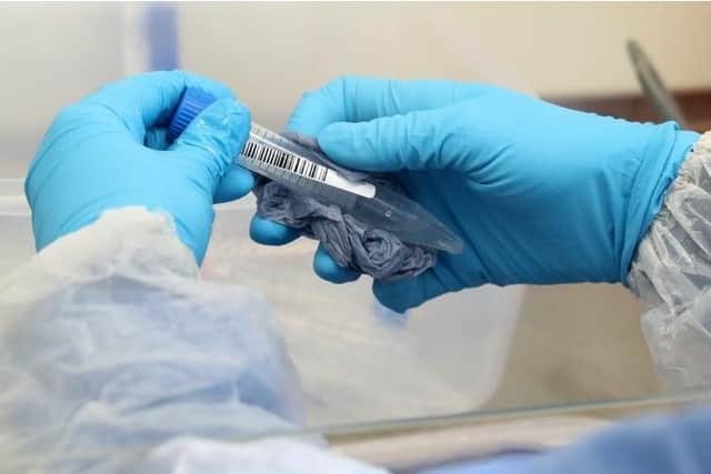 Coronavirus cases