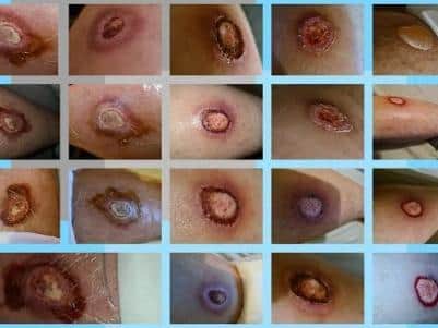 Collage of his bites