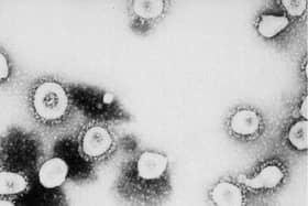 Coronavirus