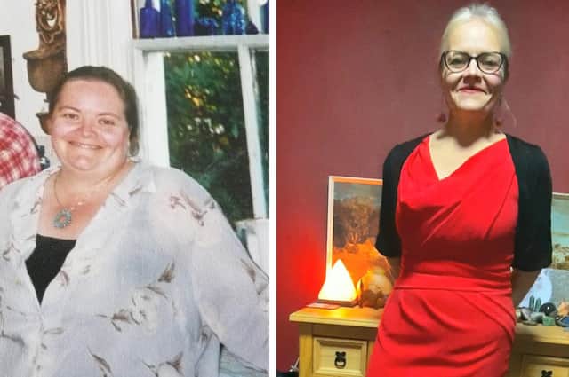 Serendipity before and after her weight loss.