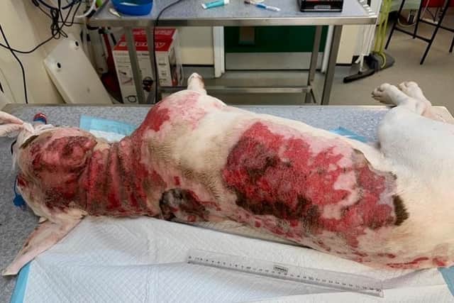 Sam had second-degree burns after a Christmas accident with boiling water