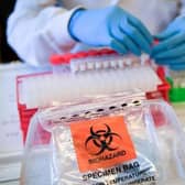 Coronavirus stock image