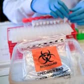 Coronavirus stock image