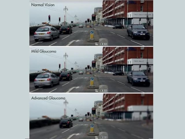 Specsavers has shared this image of what it can be like driving with Glaucoma