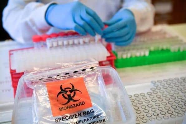 Coronavirus stock image