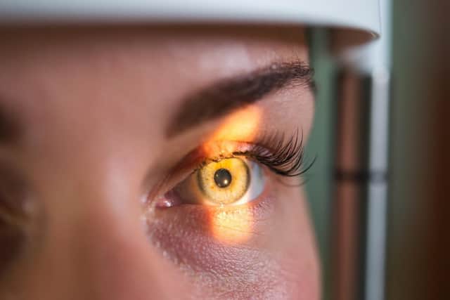 A cell biologist from Hungary has been working on curing retinitis pigmentosa, a type of degenerative eye disease