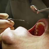 Dentist working used for illustrative purposes (Photo by Jeff J Mitchell/Getty Images)