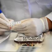 Tests must now be booked in advance at the hospitals (Photo by JOHAN ORDONEZ/AFP via Getty Images)