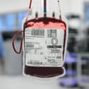 NHS bosses are particularly concerns about a lack of rare blood types