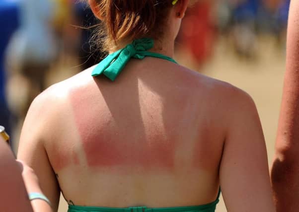 Did you get sunburnt over the weekend? Picture: Anthony Devlin/PA Wire