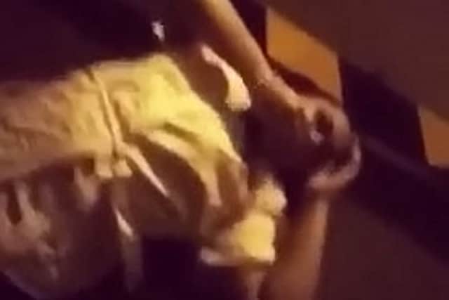 Chanyce Chambers shows off her broken tooth after drunken car park limbo antics