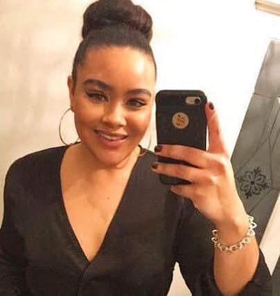 Chanyce Chambers shows off her broken tooth after drunken car park limbo antics