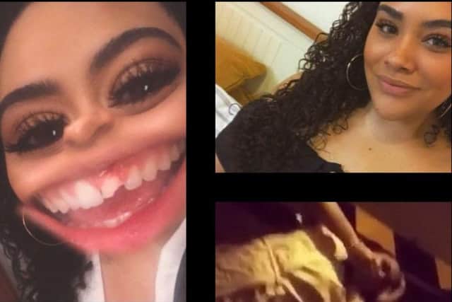 Chanyce Chambers shows off her broken tooth after drunken car park limbo antics