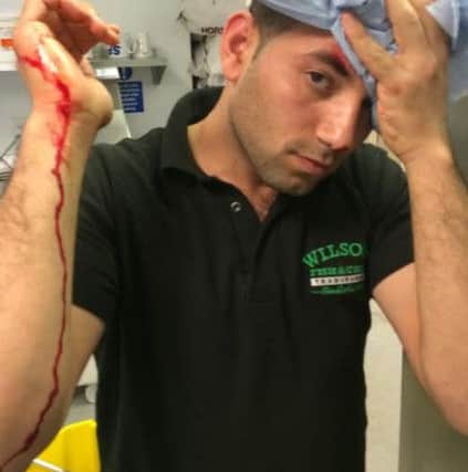 Boss of Wilsons Fish & Chips in Tring Shaban Azam was attacked with a vinegar bottle PNL-140409-180246001