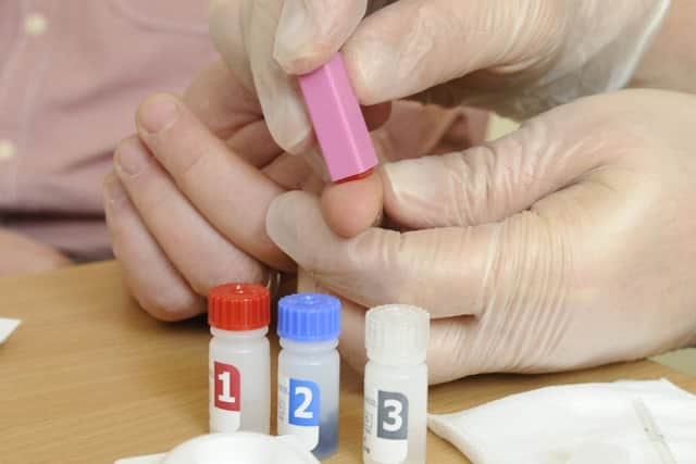 Testing for HIV