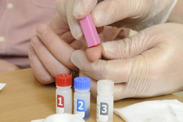 Fingerprick HIV testing can give initial results in minutes