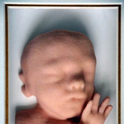 The models can either be presented in a box or mounted in a frame for the wall. Photo: SWNS