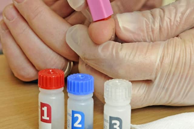 HIV testing is quick and easy.