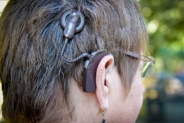 Molly Berry's cochlear implant