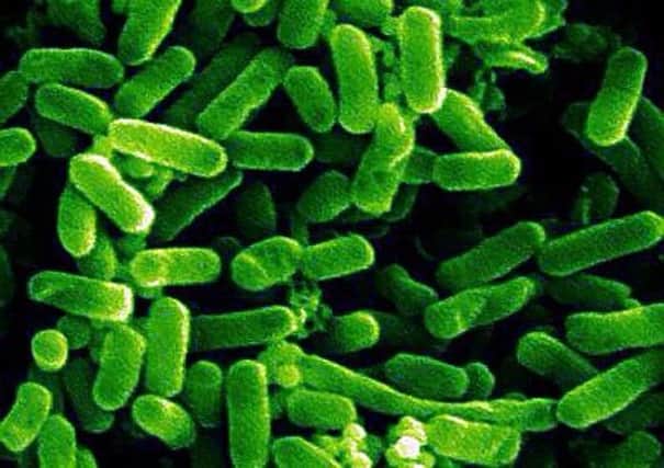 e. Coli under the microscope