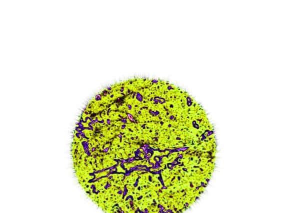 Warning over contaminated food link to C. diff superbug