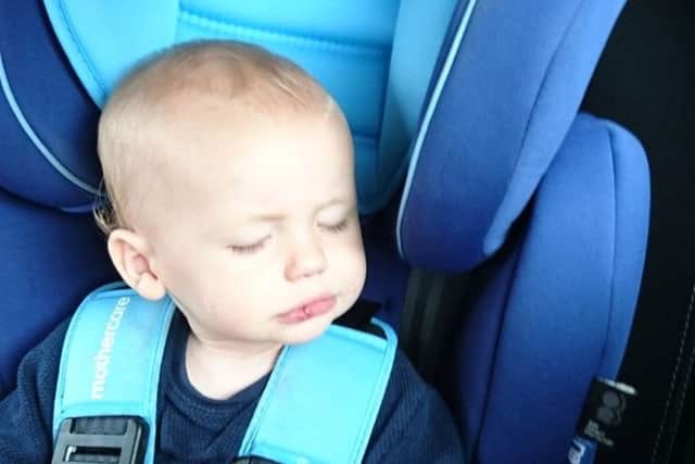 Harrison Foakes, aged one, had to be taken all the way to London to see a plastic surgeon as there was nowhere in Hemel that could see him